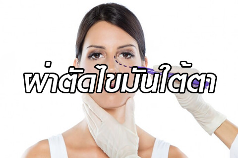 ผ่าตัดไขมันใต้ตา